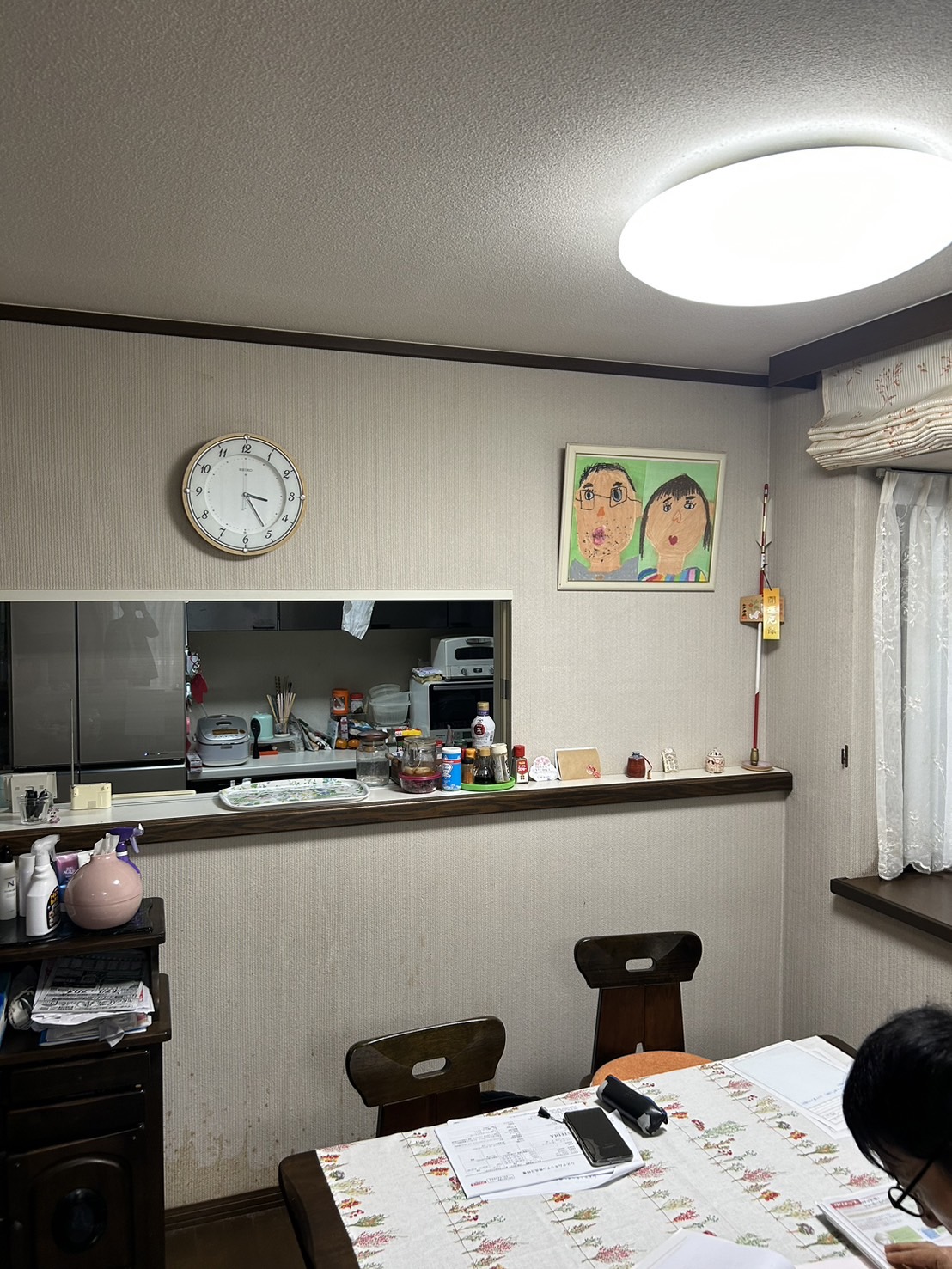 【Before】