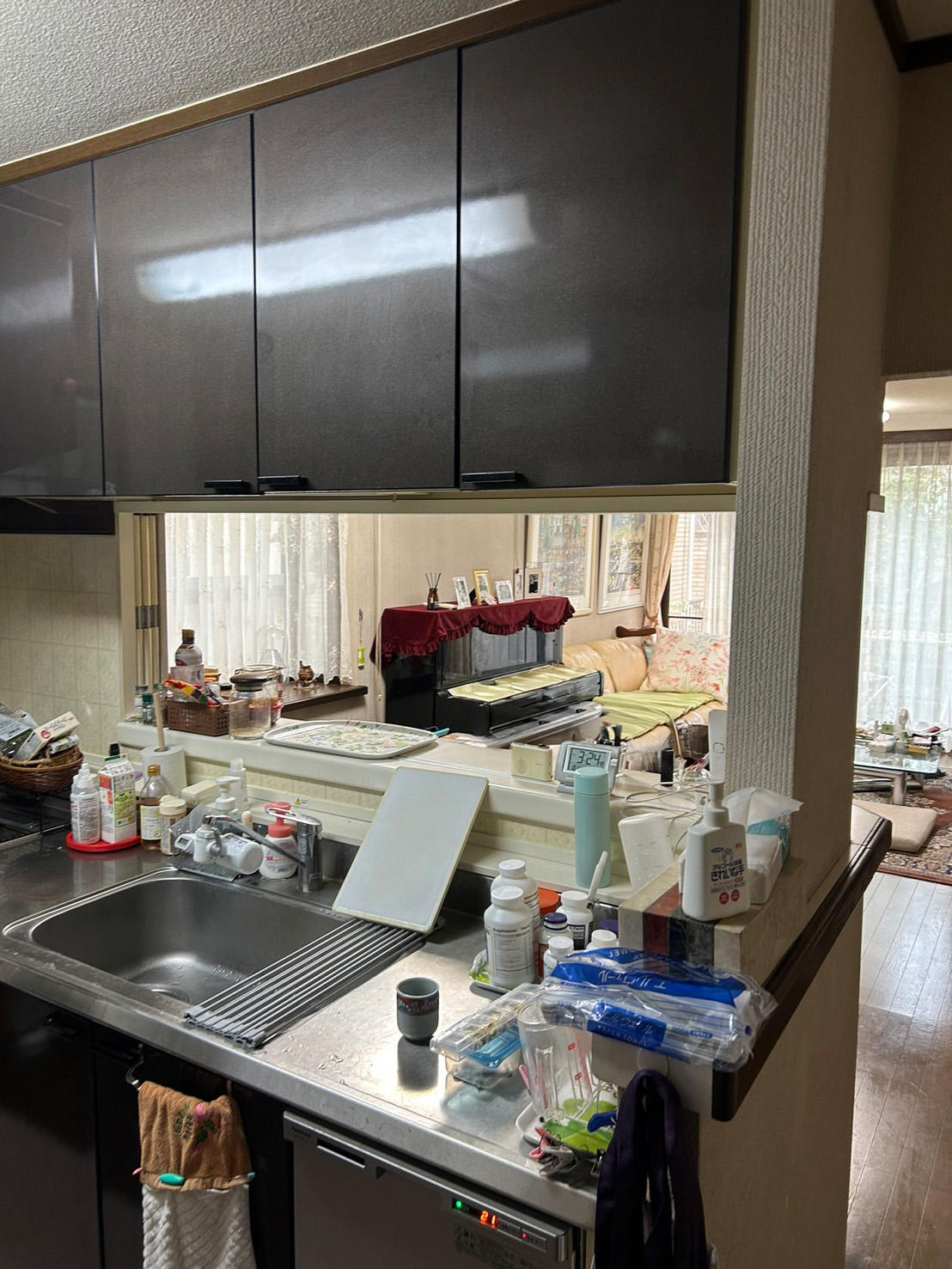 【Before】